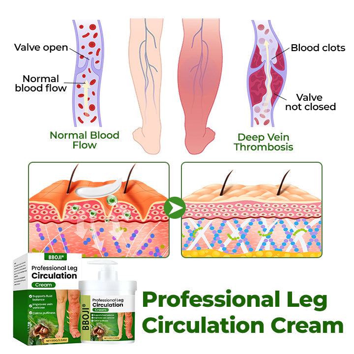 BBOJI® Professional Leg Circulation Cream-Clinically proven relief for swollen, heavy, painful legs.