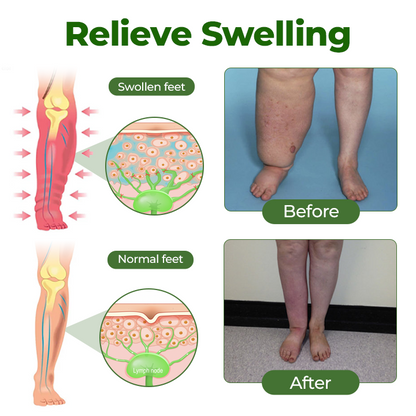 BBOJI® Professional Leg Circulation Cream-Clinically proven relief for swollen, heavy, painful legs.