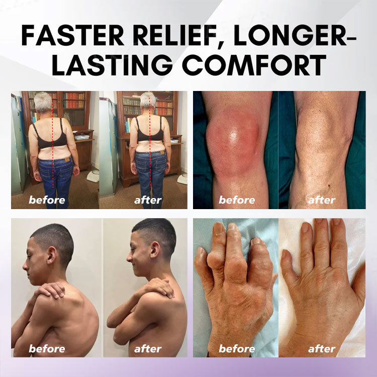 LOVILDS™ Turmeric & Emu Oil Arthritis Soothing Pain Relief Massage Gel 👨‍⚕️Australian Osteopathic Association （AOA）Approved