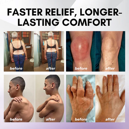 LOVILDS™ Turmeric & Emu Oil Arthritis Soothing Pain Relief Massage Gel 👨‍⚕️Australian Osteopathic Association （AOA）Approved