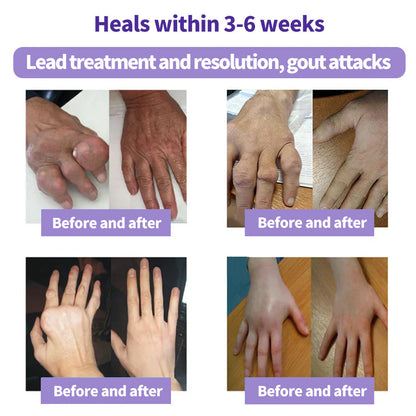 LOVILDS™ Turmeric & Emu Oil Arthritis Soothing Pain Relief Massage Gel 👨‍⚕️Australian Osteopathic Association （AOA）Approved