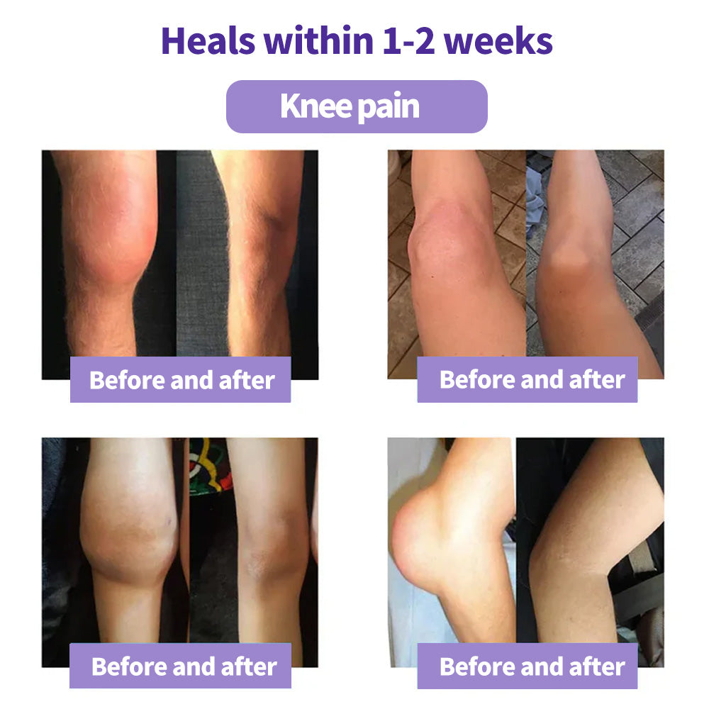 LOVILDS™ Turmeric & Emu Oil Arthritis Soothing Pain Relief Massage Gel 👨‍⚕️Australian Osteopathic Association （AOA）Approved