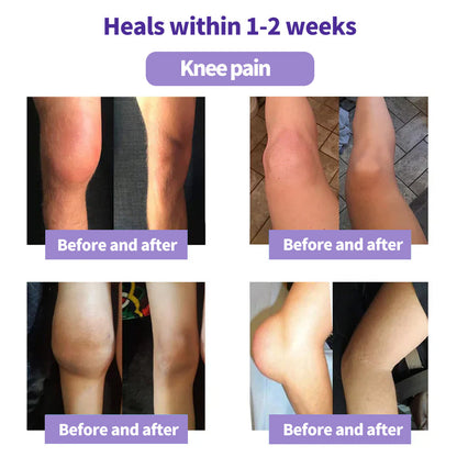 LOVILDS™ Turmeric & Emu Oil Arthritis Soothing Pain Relief Massage Gel 👨‍⚕️Australian Osteopathic Association （AOA）Approved